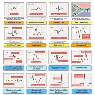 NEET 2026 PYQ Daily Quiz | Free 🎯