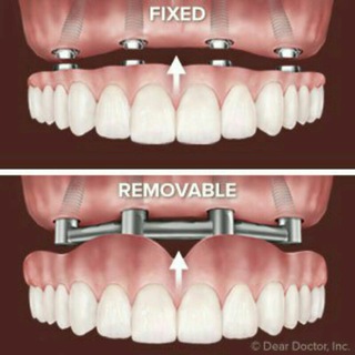 Removable & Fixed🦷👨‍⚕
