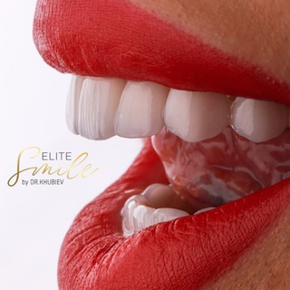 Elite Smile by DR.KHUBIEV