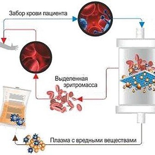 Плазмафарез личеня