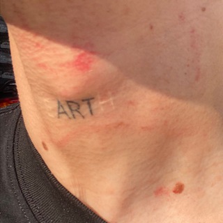 ART